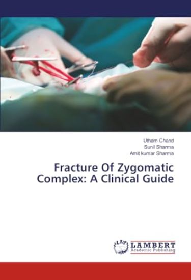 Fracture Of Zygomatic Complex