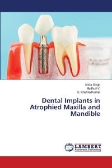 Dental Implants in Atrophied Maxilla and Mandible