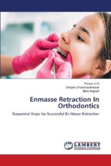 Enmasse Retraction In Orthodontics