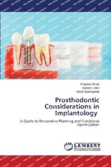 Prosthodontic Considerations in Implantology