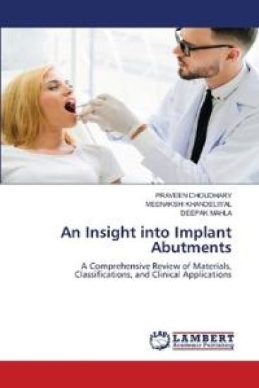 An Insight into Implant Abutments