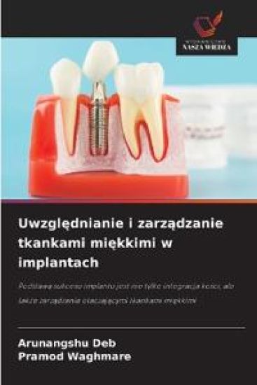 Uwzglednianie i zarzadzanie tkankami miekkimi w implantach
