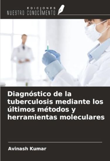 Diagnóstico de la tuberculosis mediante los últimos métodos y herramientas moleculares