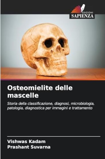 Osteomielite delle mascelle