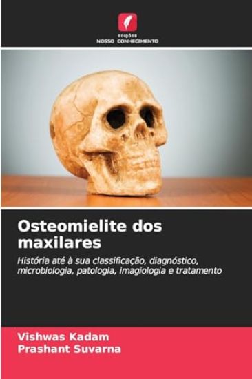 Osteomielite dos maxilares