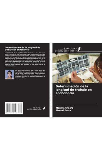 Determinación de la longitud de trabajo en endodoncia