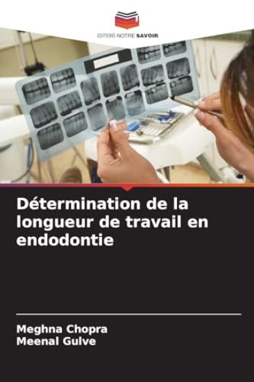 Détermination de la longueur de travail en endodontie