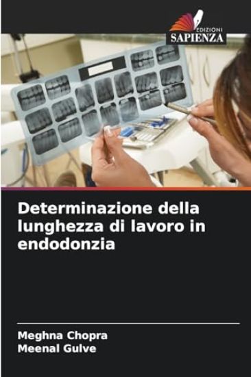 Determinazione della lunghezza di lavoro in endodonzia