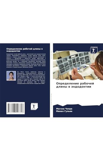 Opredelenie rabochej dliny w ändodontii