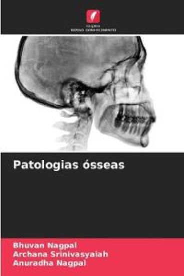 Patologias ósseas