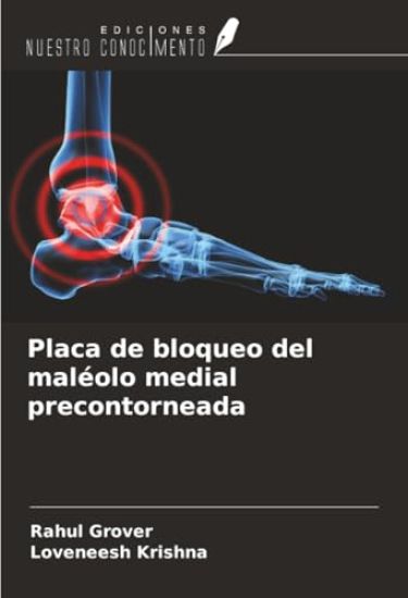Placa de bloqueo del maléolo medial precontorneada