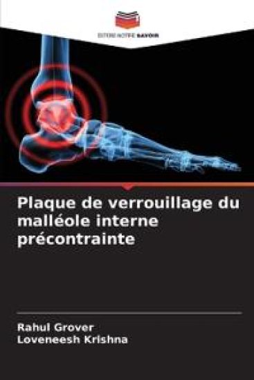 Plaque de verrouillage du malléole interne précontrainte