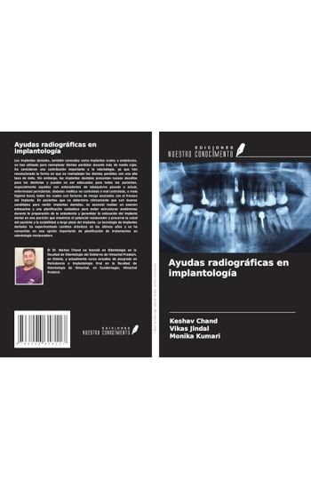 Ayudas radiográficas en implantología