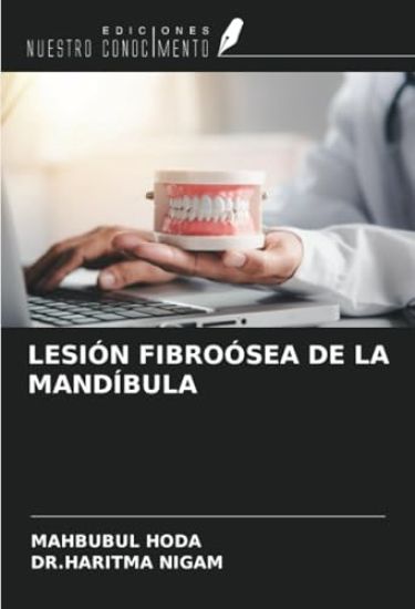 LESIÓN FIBROÓSEA DE LA MANDÍBULA