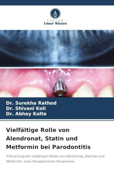 Vielfältige Rolle von Alendronat, Statin und Metformin bei Parodontitis