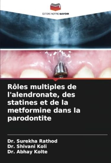 Rôles multiples de l'alendronate, des statines et de la metformine dans la parodontite
