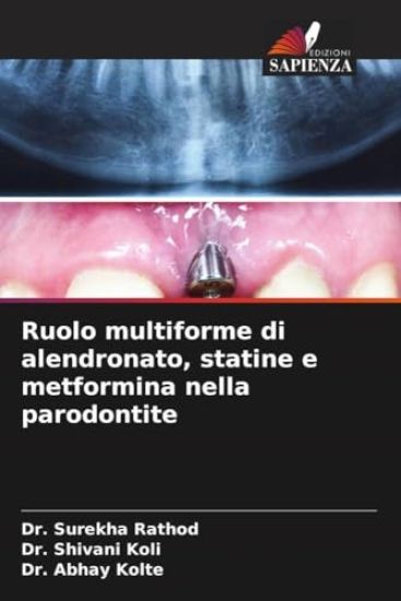 Ruolo multiforme di alendronato, statine e metformina nella parodontite
