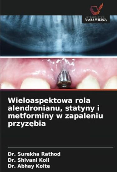 Wieloaspektowa rola alendronianu, statyny i metforminy w zapaleniu przyzebia