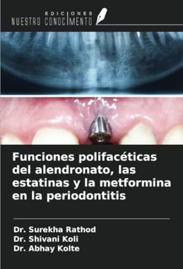Funciones polifacéticas del alendronato, las estatinas y la metformina en la periodontitis