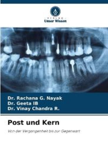 Post und Kern