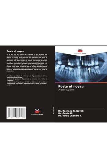 Poste et noyau