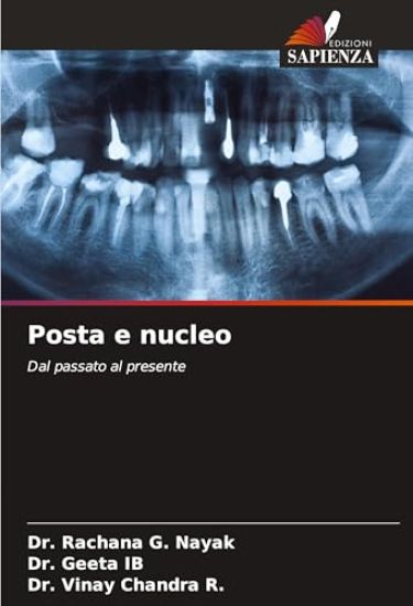 Posta e nucleo