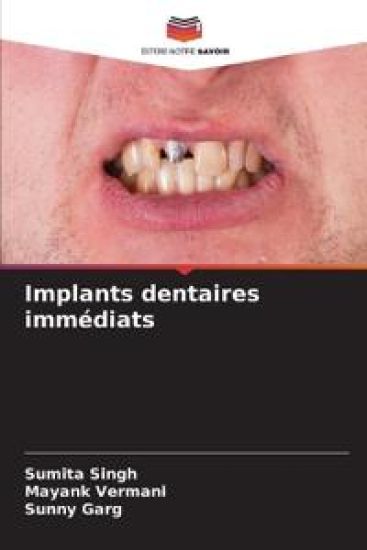 Implants dentaires immédiats
