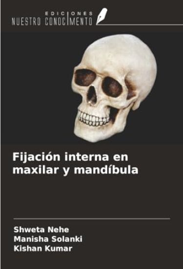 Fijación interna en maxilar y mandíbula
