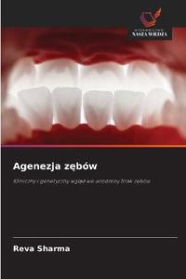Agenezja zebów