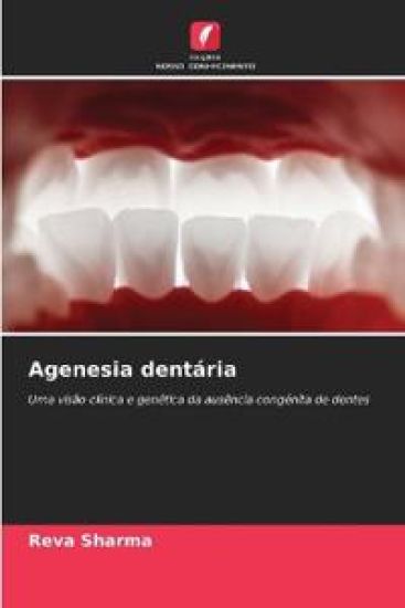 Agenesia dentária