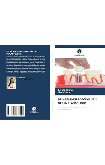 Belastungsprotokolle in Der Implantologie