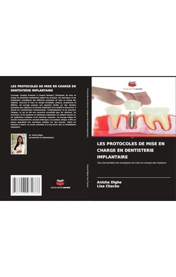 Les Protocoles de Mise En Charge En Dentisterie Implantaire