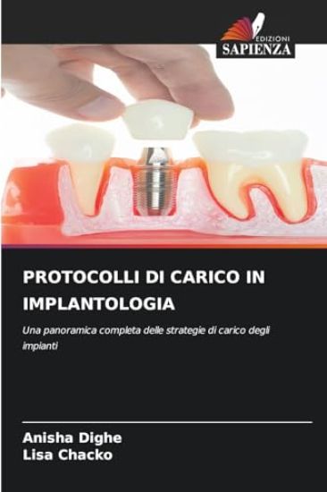 Protocolli Di Carico in Implantologia