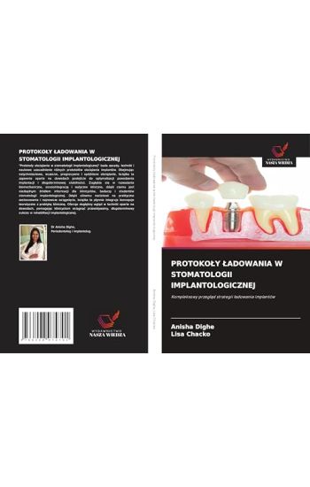 Protokoly Ladowania W Stomatologii Implantologicznej