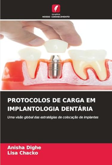 Protocolos de Carga Em Implantologia Dentária