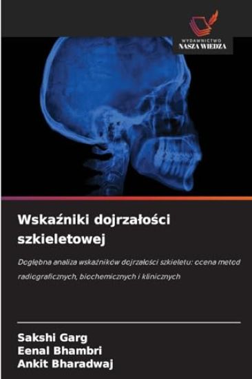 Wskaźniki dojrzalości szkieletowej