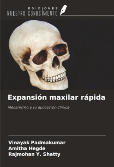 Expansión maxilar rápida