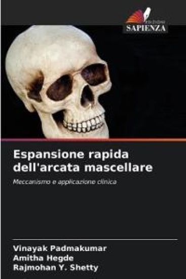 Espansione rapida dell'arcata mascellare
