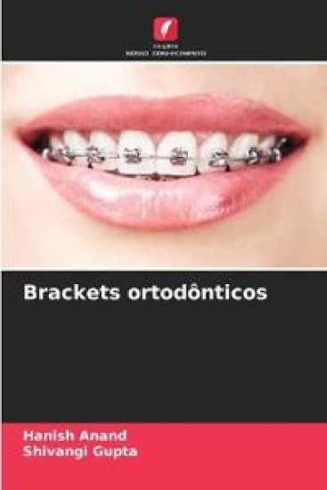 Brackets ortodônticos