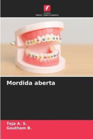 Mordida aberta