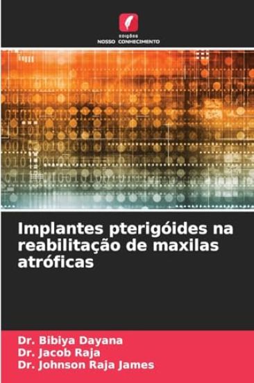 Implantes pterigóides na reabilitação de maxilas atróficas