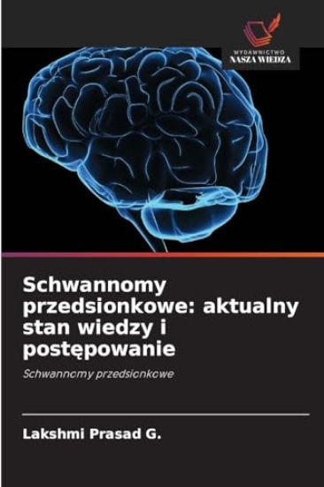 Schwannomy przedsionkowe: aktualny stan wiedzy i postępowanie