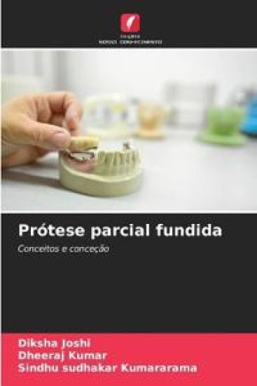 Prótese parcial fundida