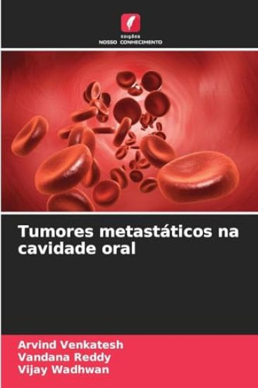 Tumores metastáticos na cavidade oral