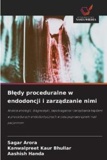 Bledy proceduralne w endodoncji i zarzadzanie nimi