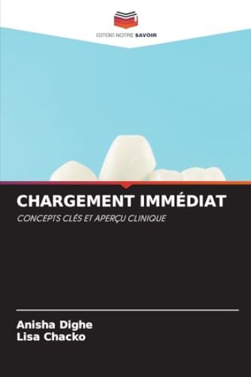 Chargement Immédiat