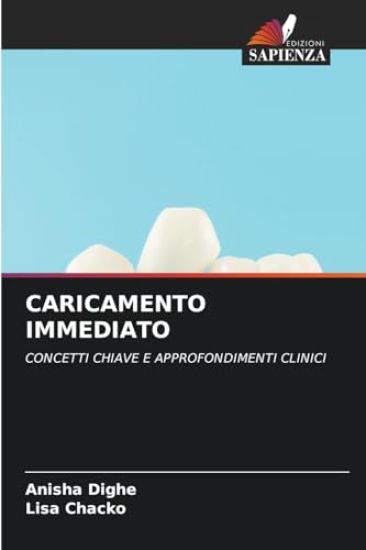 Caricamento Immediato