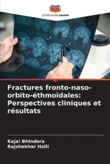 Fractures fronto-naso-orbito-éthmoïdales