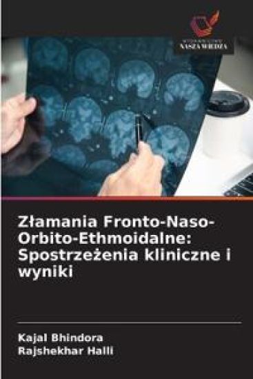 Zlamania Fronto-Naso-Orbito-Ethmoidalne