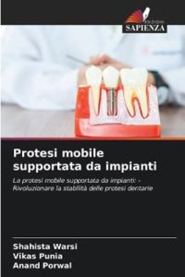 Protesi mobile supportata da impianti